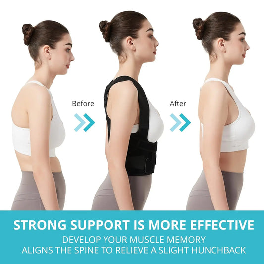 Back Brace Posture Corrector for Women and Men